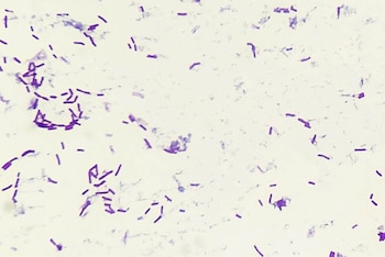 El equipo estudia distintas especies de Bacillus y Trichoderma, principalmente por su potencial frente a enfermedades del garbanzo y el maní