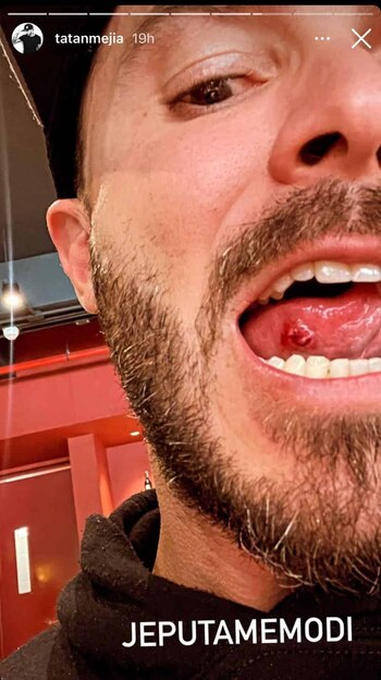 “Me duele mucho”, Tatán Mejía