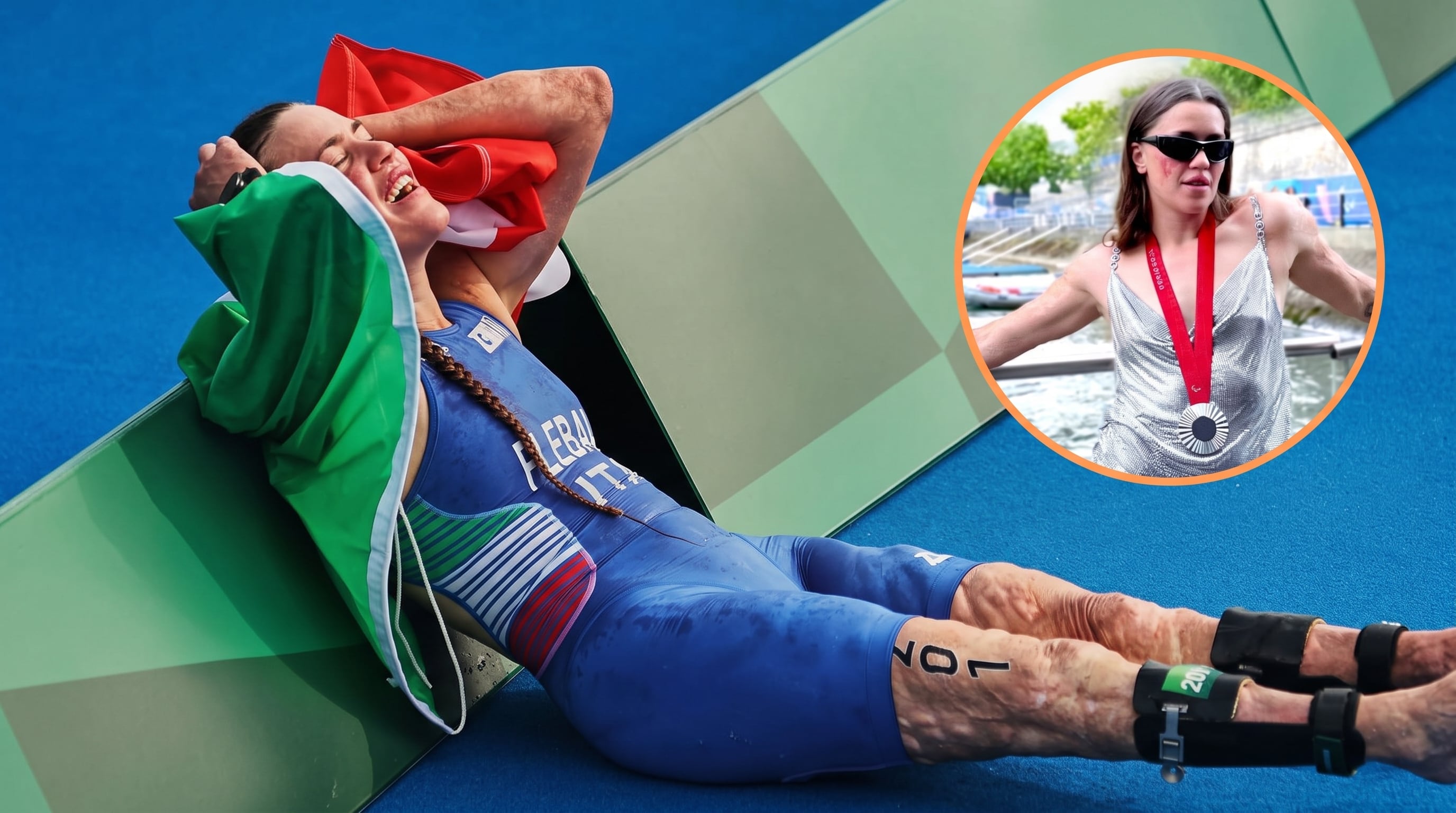 Una triatleta italiana convirtió su secuela por meningitis en influencia global
