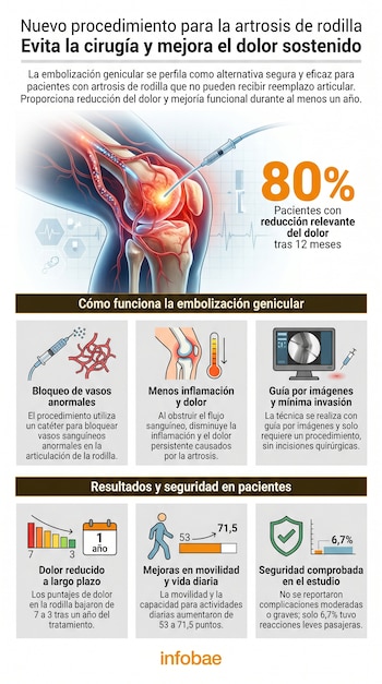 Infografía sobre embolización genicular para artrosis de rodilla: ilustración anatómica de la rodilla con catéter, gráficos de resultados y porcentaje de éxito.