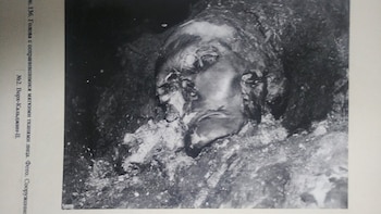 La paciente, de entre 25