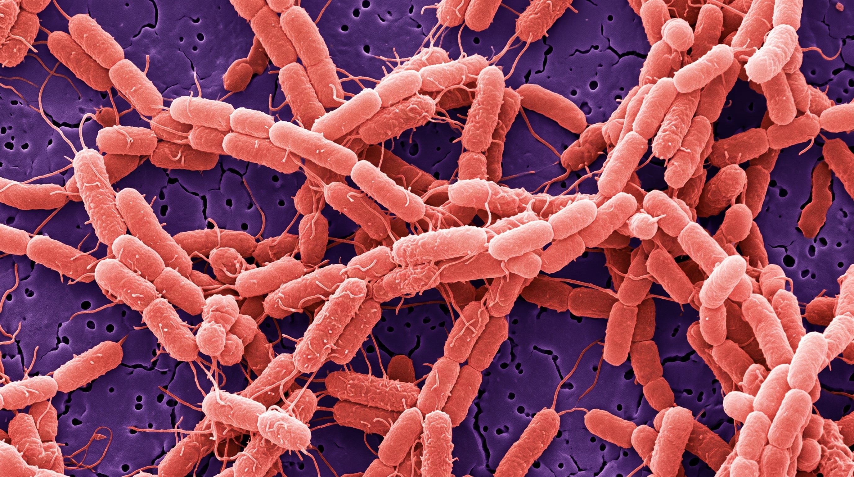 Una micrografía electrónica ilustra un grupo de bacterias de Salmonella de forma bacilar con sus flagelos. (Imagen Ilustrativa Infobae)