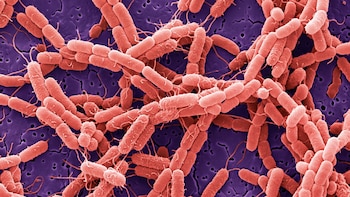 Nuevo brote de Salmonella en EE. UU.: la FDA investiga 84 casos sin identificar aún el alimento responsable