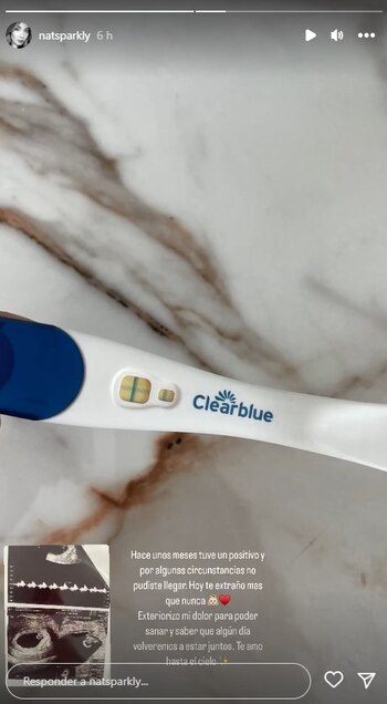 Nati Sánchez revela la pérdida