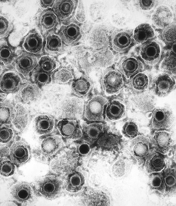 El proceso que llevó al HOVILPRI al mercado no pasó por los carriles convencionales. La FDA lo trató como una prioridad desde el primer día (CENTERS FOR DISEASE CONTROL AND PREVENTION EEUU)