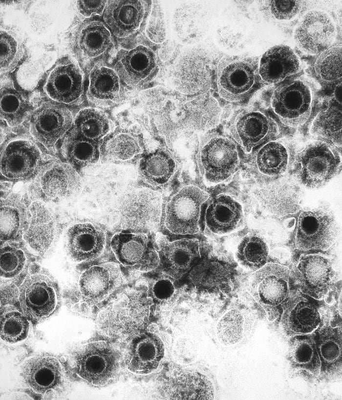 El proceso que llevó al HOVILPRI al mercado no pasó por los carriles convencionales. La FDA lo trató como una prioridad desde el primer día (CENTERS FOR DISEASE CONTROL AND PREVENTION EEUU)