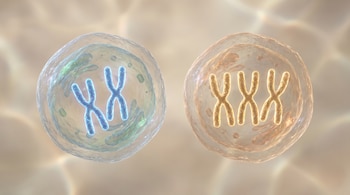 Dos células biológicas translúcidas en 3D flotando, la izquierda con dos cromosomas X azules entrelazados, la derecha con tres cromosomas X dorados.