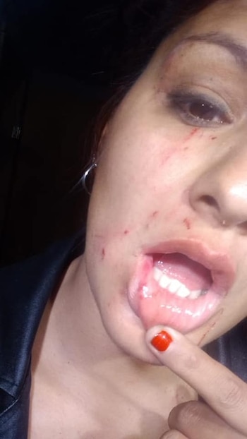 La mujer contó que su