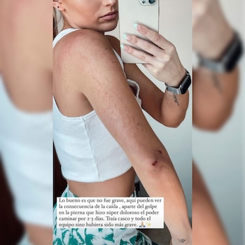 La actriz evitó heridas graves