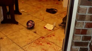 Jacqueline perdió el 30% de