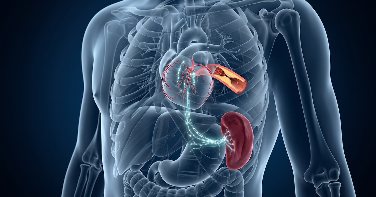 A Harvard study finds an unexpected connection between the spleen and the risk of coronary disease
