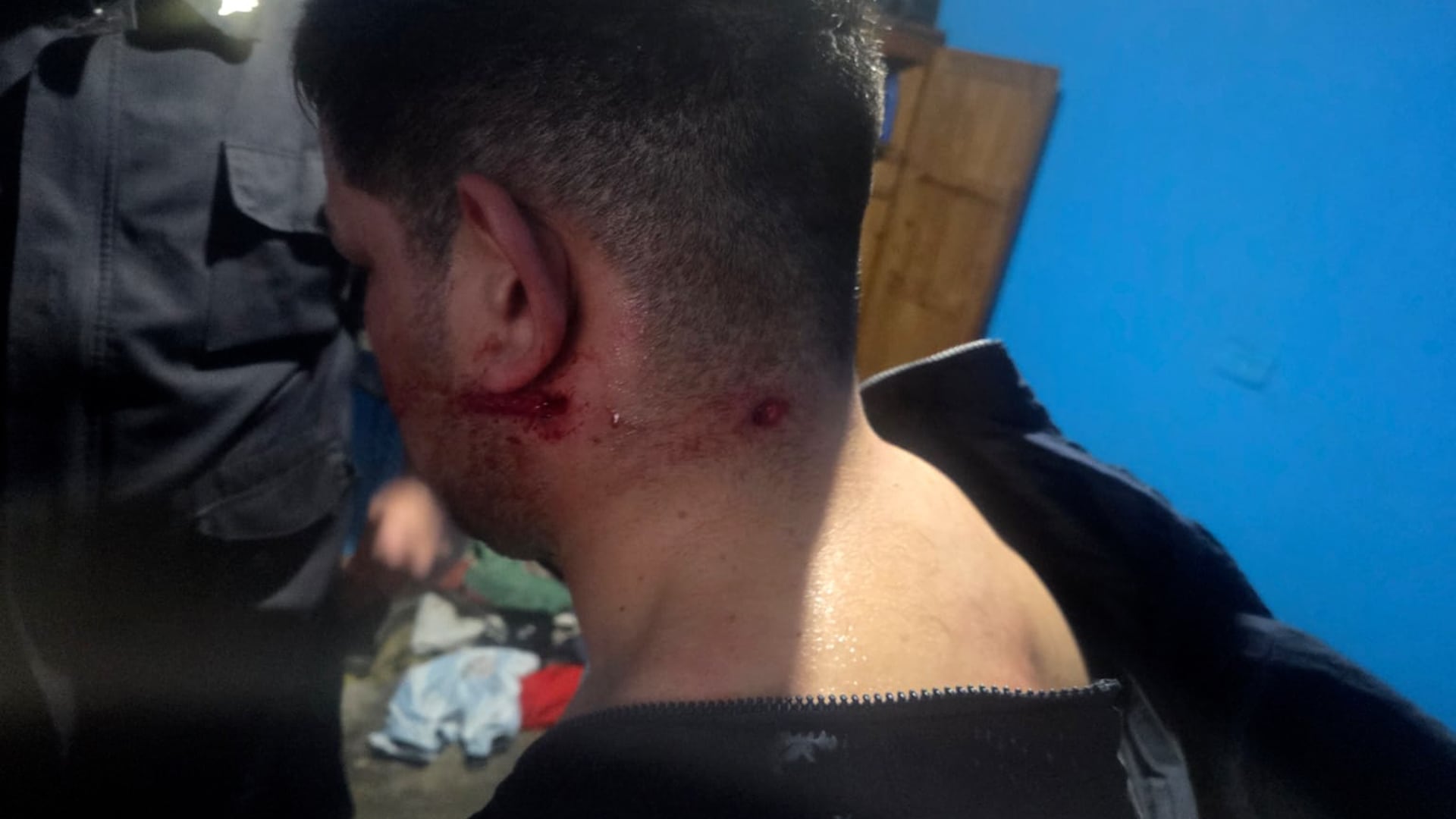 Al momento de su detención, Rodríguez tenía una herida de arma de fuego en la zona izquierda del cuello.