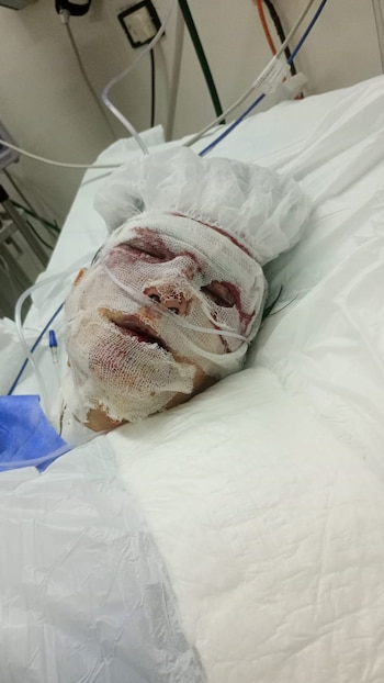 La víctima permanece internada en