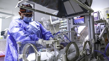 Proeza médica en Perú: cirujanos del Incor corrigieron una malformación cardíaca en un bebé prematuro de apenas 1,6 kilos
