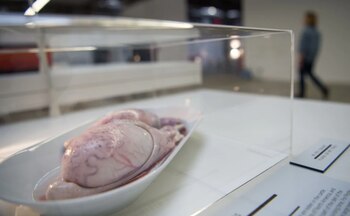 "Rocky Mountain Oysters": testículos de