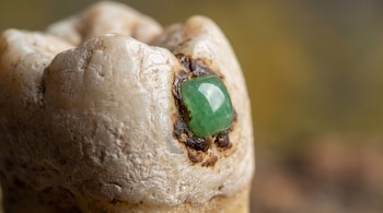Primer plano de diente antiguo con incrustación de jade verde y restos de resina oscura en el esmalte, sobre fondo desenfocado.