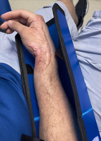 También mostró cómo le quedó