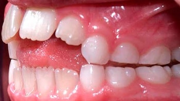 Ministerio de Salud alerta de