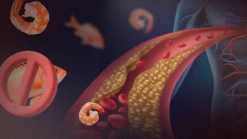 Cuáles son los efectos de