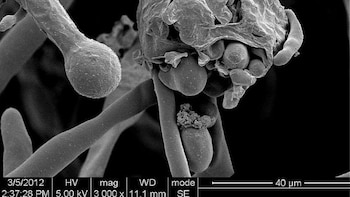 Qué es el hongo negro: