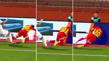 La escalofriante lesión que sufrió