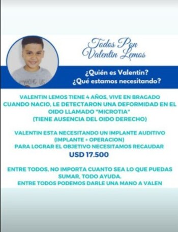 Valentín Lemos necesitaba la plata para un implante auditivo