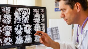 El científico Pastor cree que