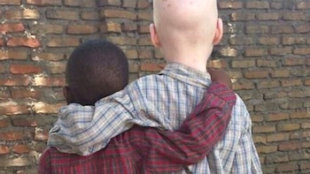 (Amnesty International)