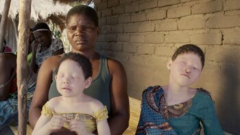 Actualmente hay en Malawi entre