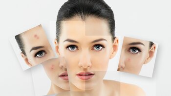 Existen diferentes tipos de láser