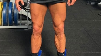 Así lucen las piernas de