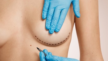 La cirugía de aumento mamario