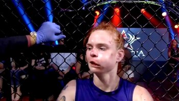 Así quedó el rostro de