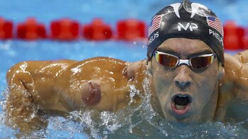 Michael Phelps sorprendió en los Juegos Olímpicos de Rio con unos llamativos hematomas (Reuters)