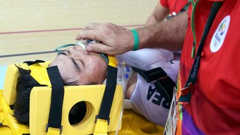 El golpe que sufrió fue