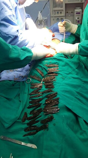 (Cortesía del Hospital Amritsar corporativa,