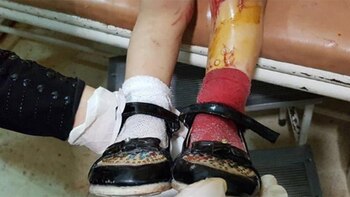 Los zapatos de la “Cenicienta