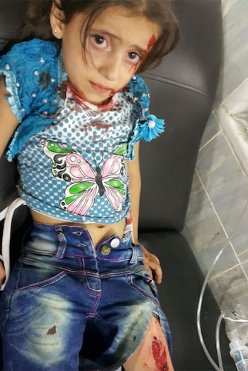 Amal Hayouk tiene 4 años.