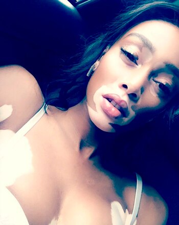 Winnie Harlow se consolidó como modelo cuando realizó la campaña de la marca Desigual