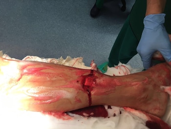 La pierna derecha de José