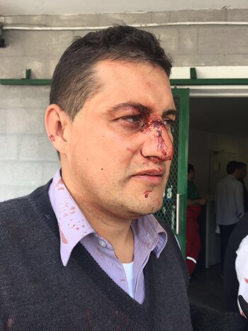 Imagen 7NBXIPJRKRHZFNZB5GQBJH64EI