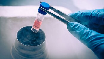 Una encuesta de la OIE