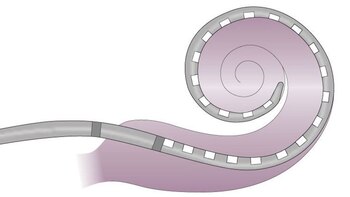 El implante debe colocar en