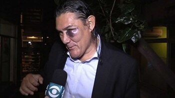 Así le quedó el rostro