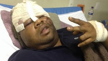 “Fat Family” después del operativo policial en el que resultó herido en junio pasado