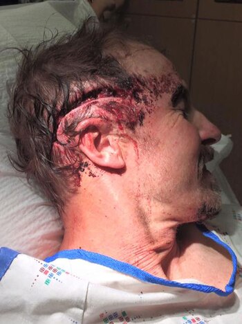 La osa le provocó una