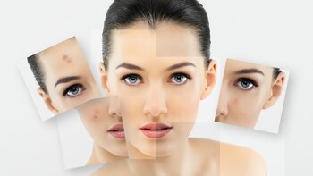 Cuidarse la piel es esencial