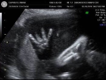 Las primeras imágenes de Félix