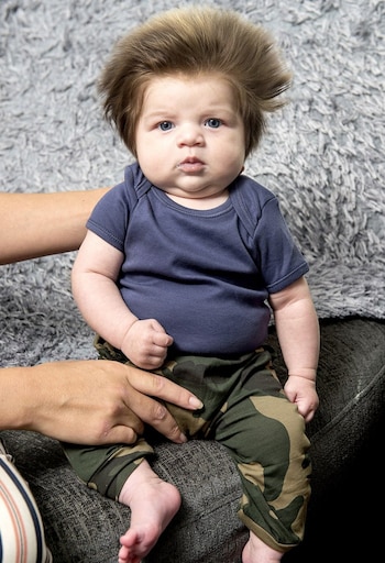 En algunos casos los bebés