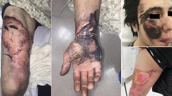 Los cigarrilos electrónicos pueden dejar